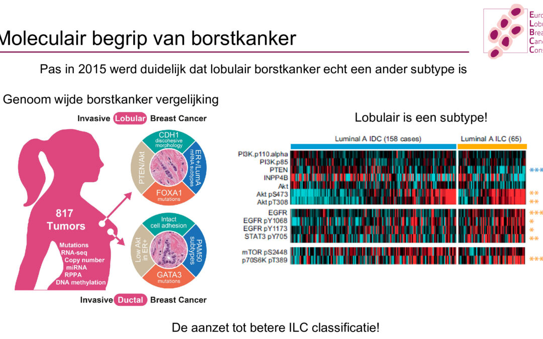 Verslag drieluik Lobulair Borstkanker